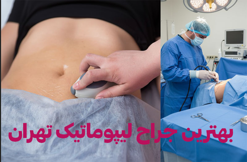 بهترین-جراح-لیپوماتیک-تهران دکتر لیپوماتیک تهران