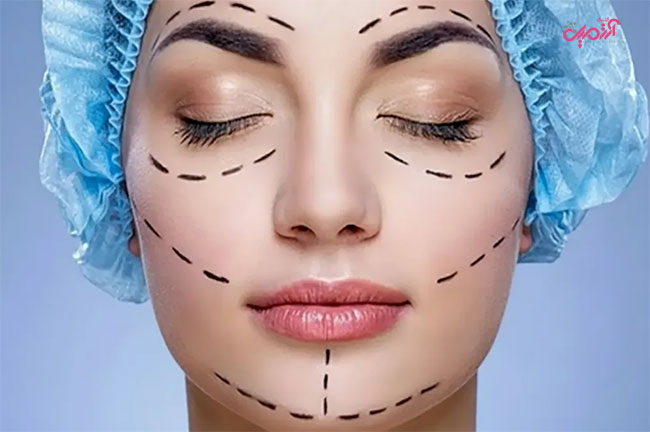 جراحی پلاستیک