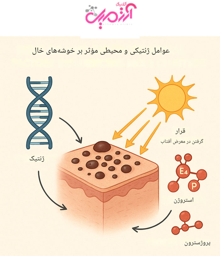 علت‌های ایجاد خال روی پوست 