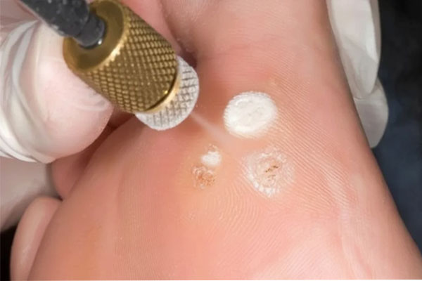 قیمت خدمات کرایوتراپی