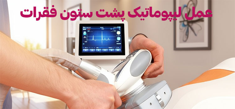 لیپوماتیک-ستون-فقرات لیپوماتیک-ستون-فقرات