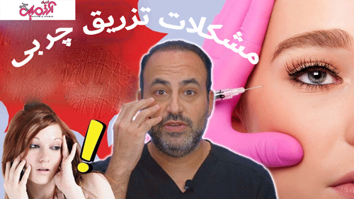 محدودیت‌ها-و-عوارض-احتمالی-پس-از-تزریق-چربی