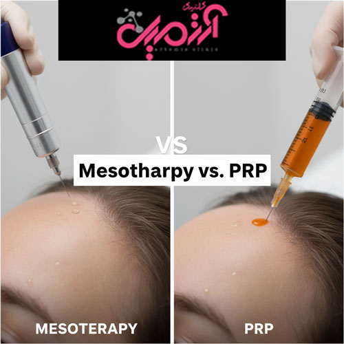 مدت زمان درمان و مقایسه مزوتراپی با روش‌ های جایگزین