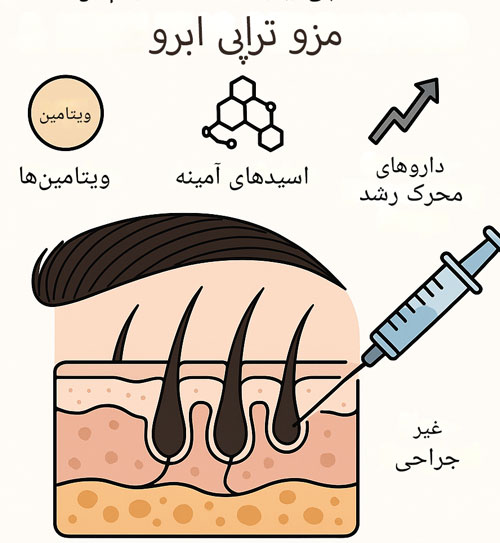مزوتراپی-ابرو-چیست-و-چگونه-انجام-می-شود مزوتراپی ابرو چیست و چگونه انجام می شود