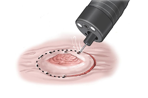 نقش فیزیولوژی در فرایند انجماد سلولی