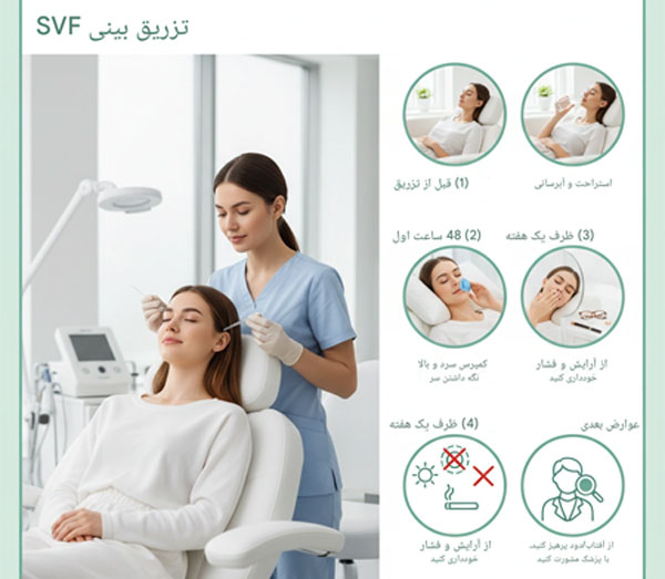 تزریق ژل SVF بینی