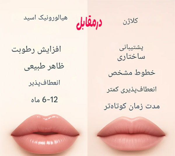 مقایسه-فیلر-هیالورونیک-و-کلاژن مقایسه فیلر هیالورونیک و کلاژن