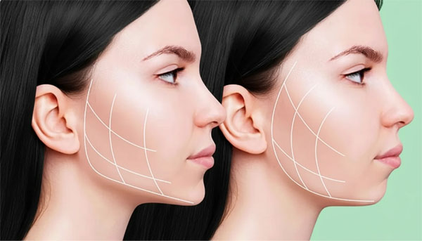 نقش سلول stromal در بازسازی بافت