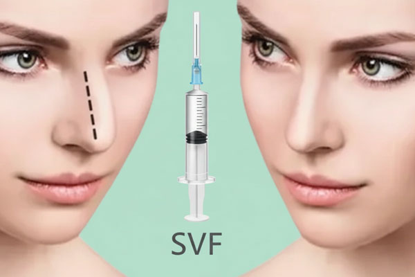 کاربرد بالینی ژل های SVF بینی