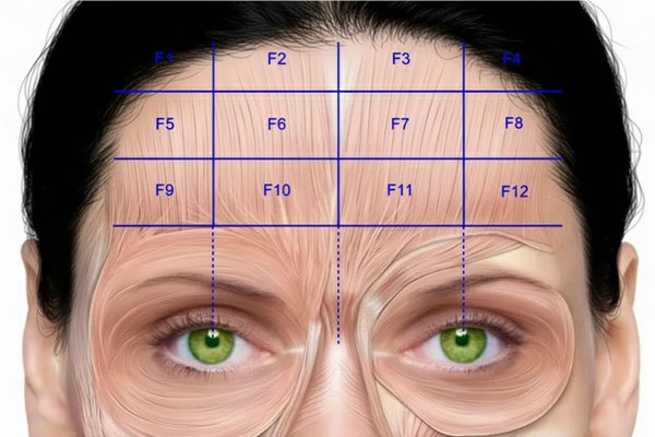 اثرات-زیبایی-تزریق SVF به پیشانی اثرات زیبایی تزریق SVF به پیشانی