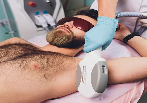 بهترین-دستگاه-لیزر-ویژه-مردان لیزر موهای زائد مردان