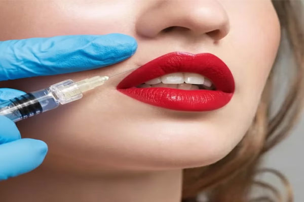 فیلر-خط-خنده-04 فیلر خط خنده