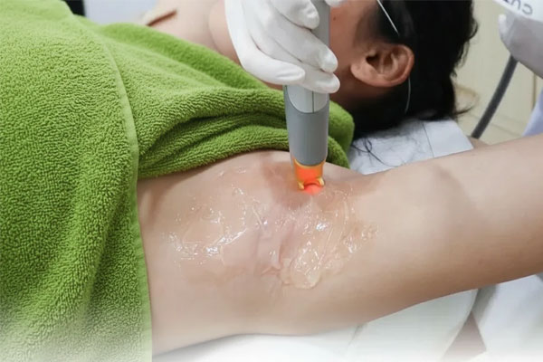 سفید کردن زیر بغل