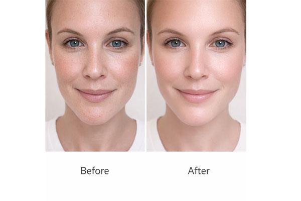 دوام و اثر این روش جوان‌سازی