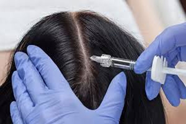 فیلر مو شاخص