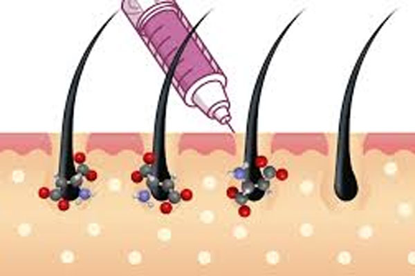 تاثیر ترکیبات بر فولیکول