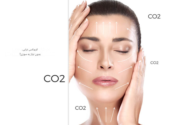 کربوکسی‌تراپی