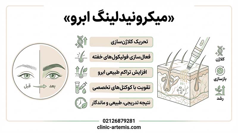 میکرونیدلینگ ابرو