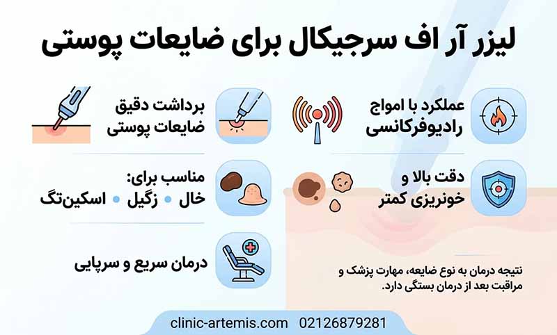 لیزر آر اف سرجیکال