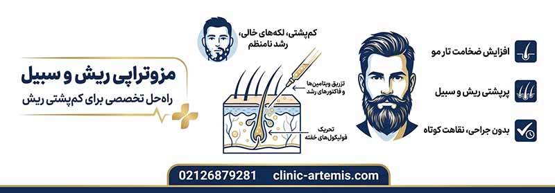 مزوتراپی ریش و سبیل