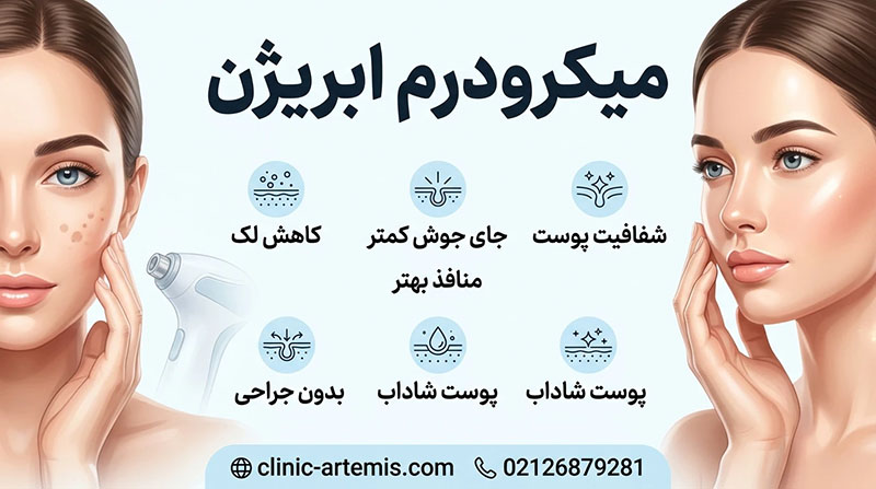 میکرودرم ابریژن