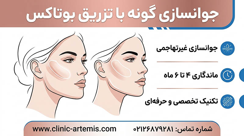 بوتاکس گونه