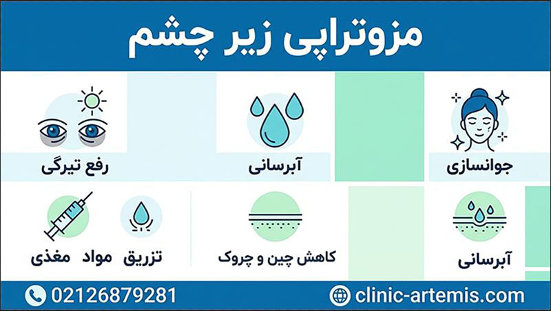 مزوتراپی زیر چشم مزوتراپی زیر چشم